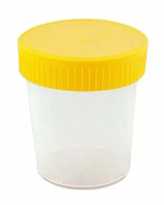 Gobelet à urine 100 ml, 100 pièces