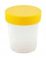 Gobelet à urine 100 ml, 100 pièces