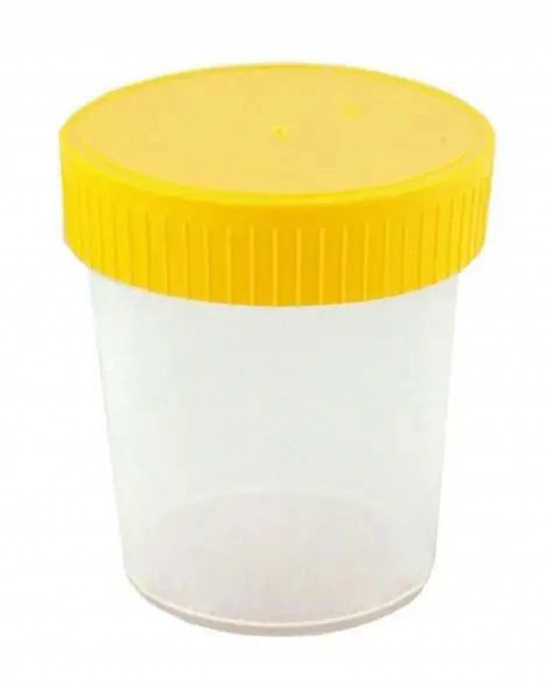 Gobelet à urine 100 ml, 100 pièces